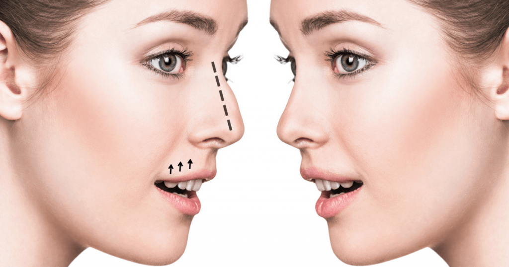 هزینه عمل بینی اقساط پرداخت تمام هزینه به صورت قسطی